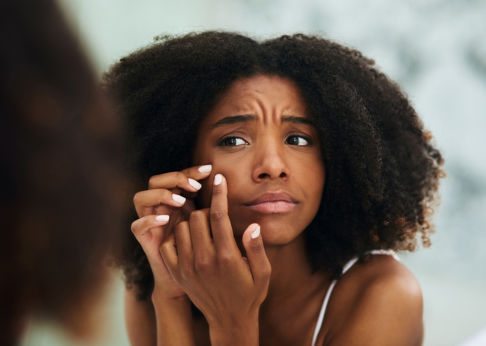 Soorten acne behandelen met duurzame huidverzorging van Leef.nl